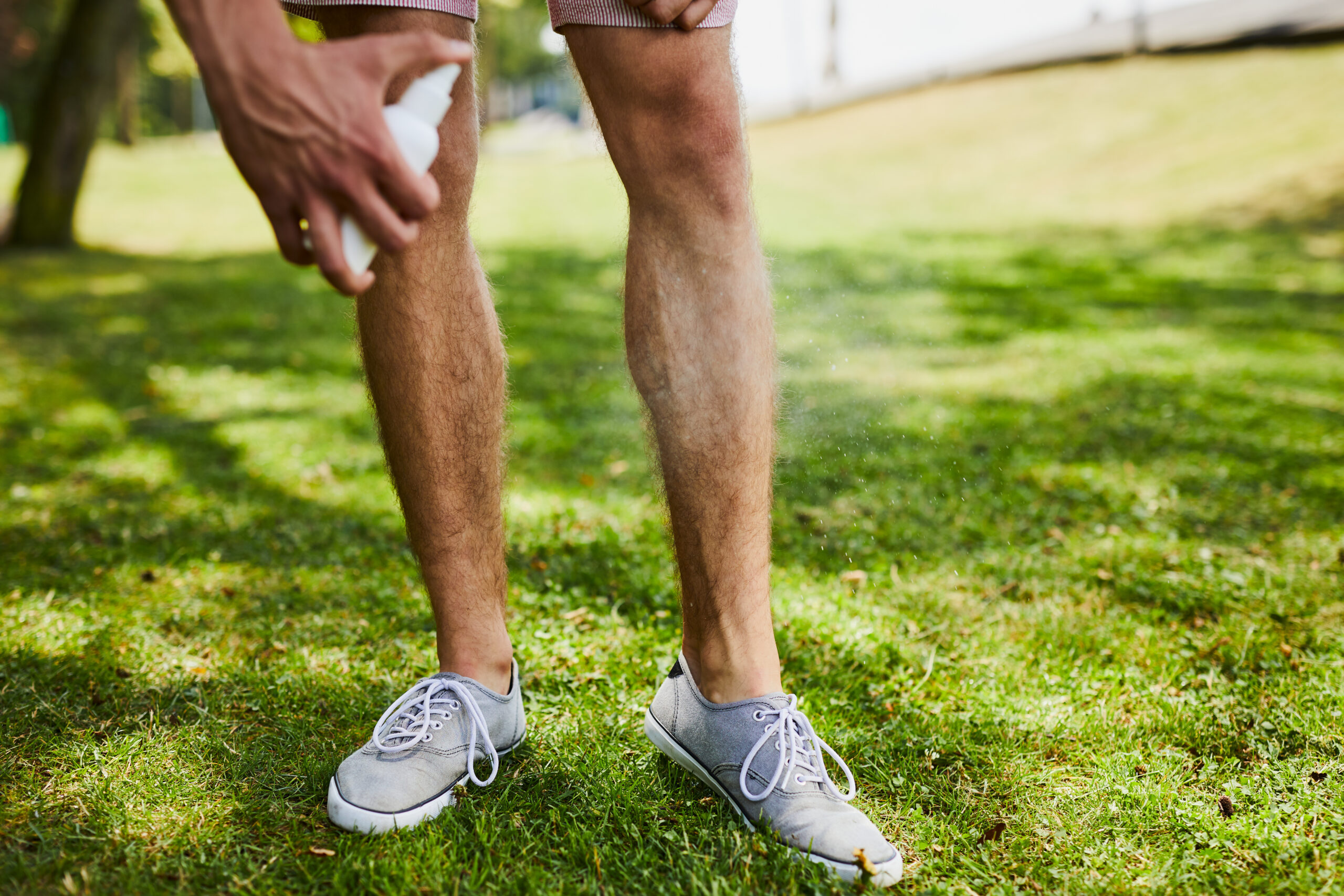 Man, standing in the grass, spraying bug spray on his bare legs