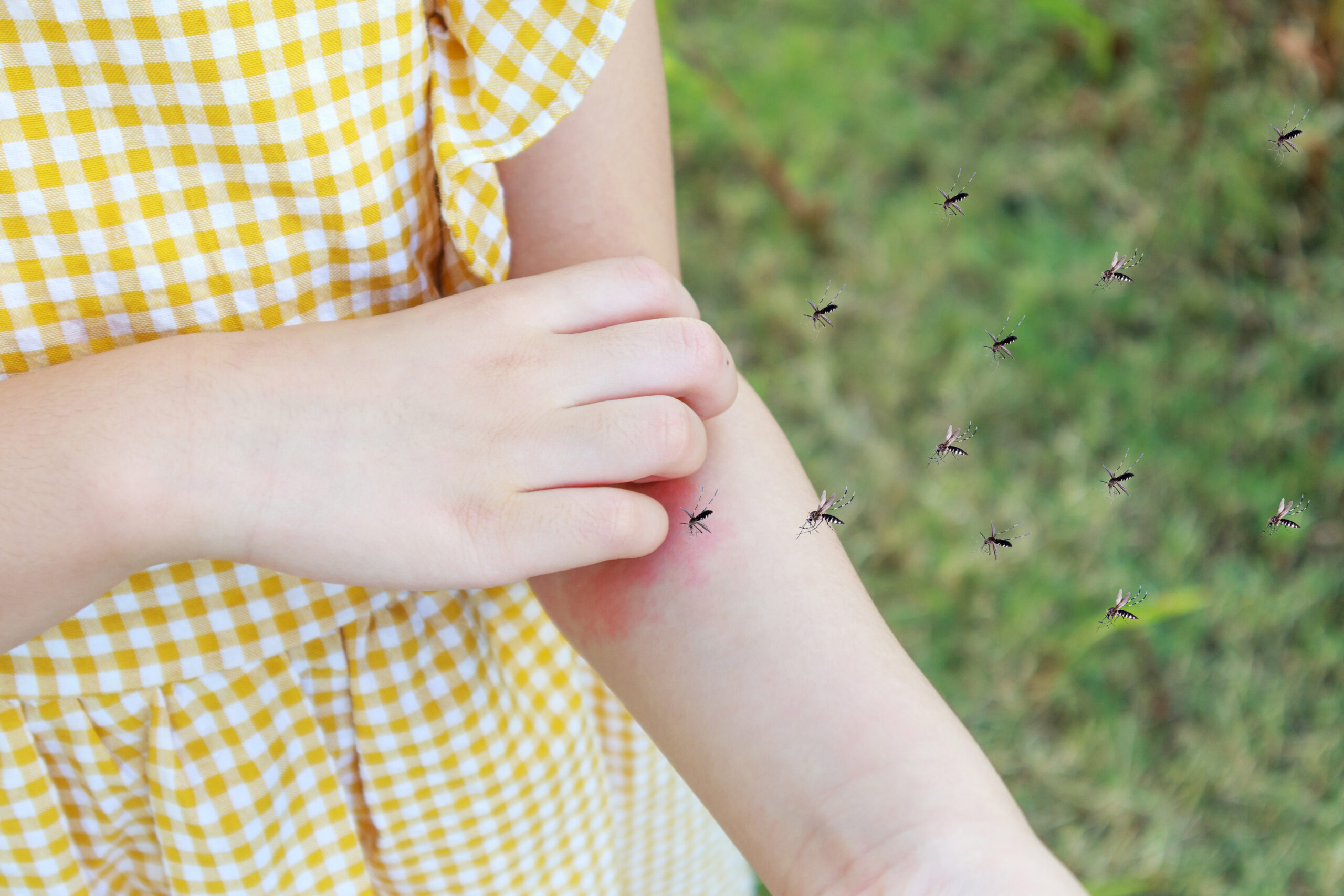 Little girl in yellow and white dress is scratching mosquito bites on her arm while a swarm of mosquitoes fly around